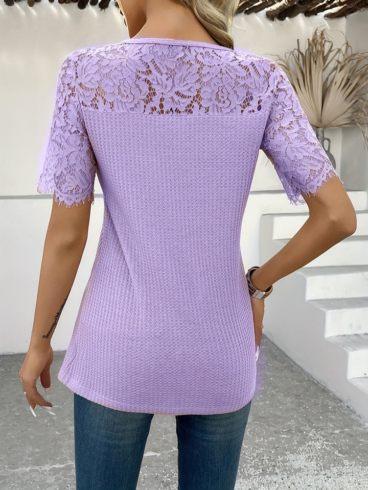 Josie | Lace-Trimmed Button-Detail Tunic
