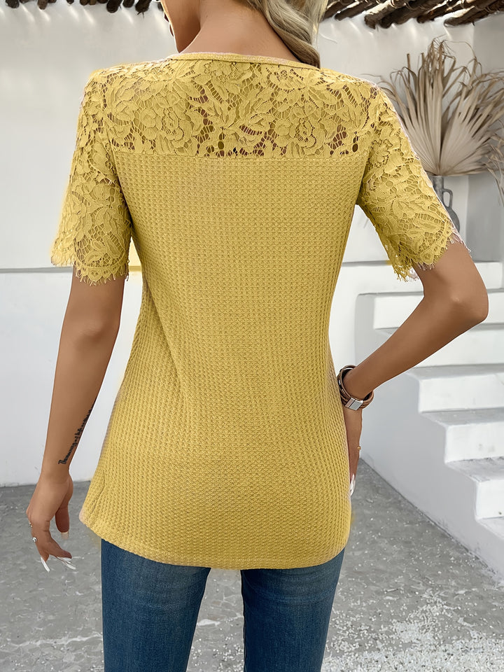 Josie | Lace-Trimmed Button-Detail Tunic